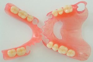 эластичный зубной протез фото